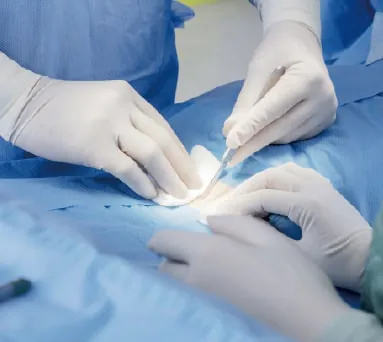 Surgical Gloves